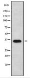 Phospho-ANXA2 (Ser26) Antibody