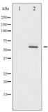 Phospho-Akt2 (Ser474) Antibody