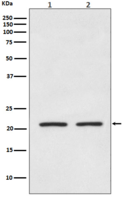 AKAP14 Antibody