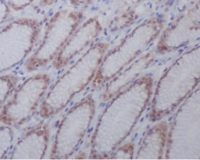 active + pro Caspase 3  Antibody 