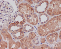 TLR2 Antibody