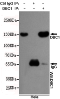 DBC1 Mouse mAb