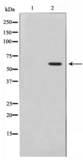 Phospho-Akt (Thr308) Antibody