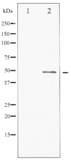 Phospho-ATF2 (Ser62 or 44) Antibody