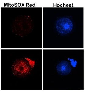 MitoSOX Red（线粒体超氧化物检测红色荧光探针）