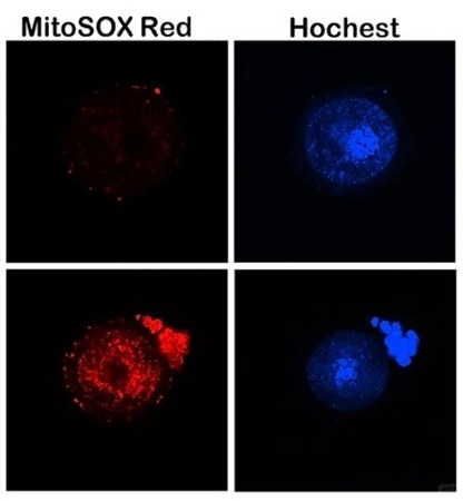 MitoSOX Red（线粒体超氧化物检测红色荧光探针）