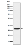 TCTP Antibody