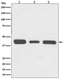 67kDa Laminin Receptor Antibody
